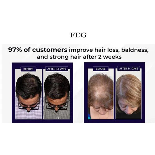 FEG PLUS Hair Growth Spray Discount Deal.PK