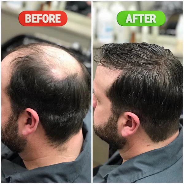 Rosemary & Rice Water Hair Growth Spray - 200ml Official Discount Deal Limited time Offer