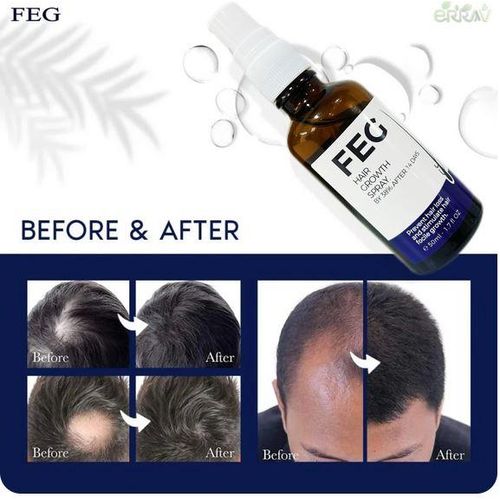 FEG PLUS Hair Growth Spray Discount Deal.PK